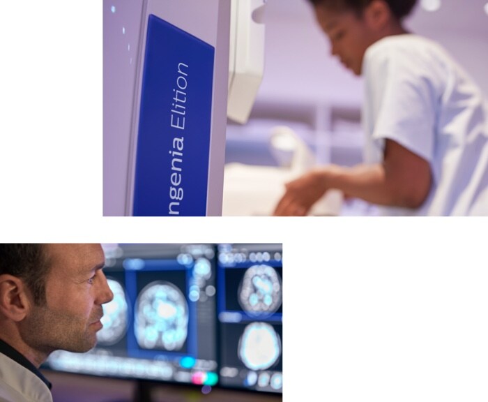 MR Diffusion-Perfusion helps physicians distinguish potentially reversible from irreversible ischemia