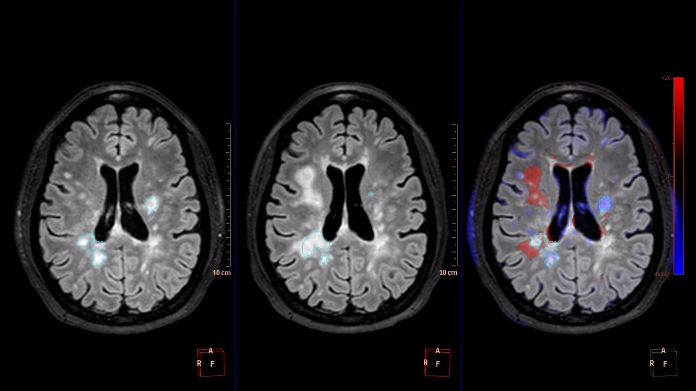 Comparative Brain Imaging