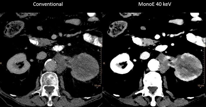 MonoE Comparison