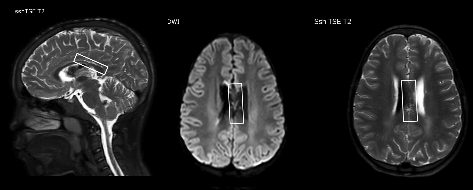 clinical case 1