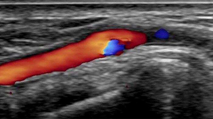 CX50 ultrasound system