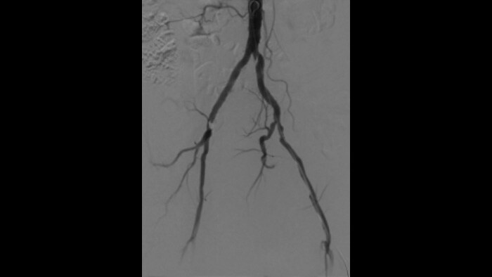 ClarityIQ fluoroscopy