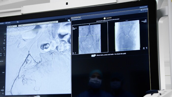 Zero-dose positioning for CBCT acquisition